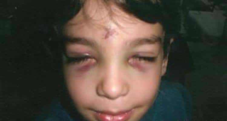 Niño de 5 años aplastado por una valla