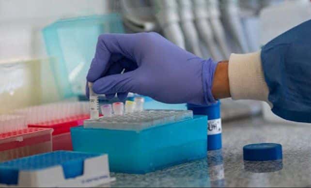 Coronavirus: sin test rápidos, son 80 los nuevos casos positivos detectados por PCR