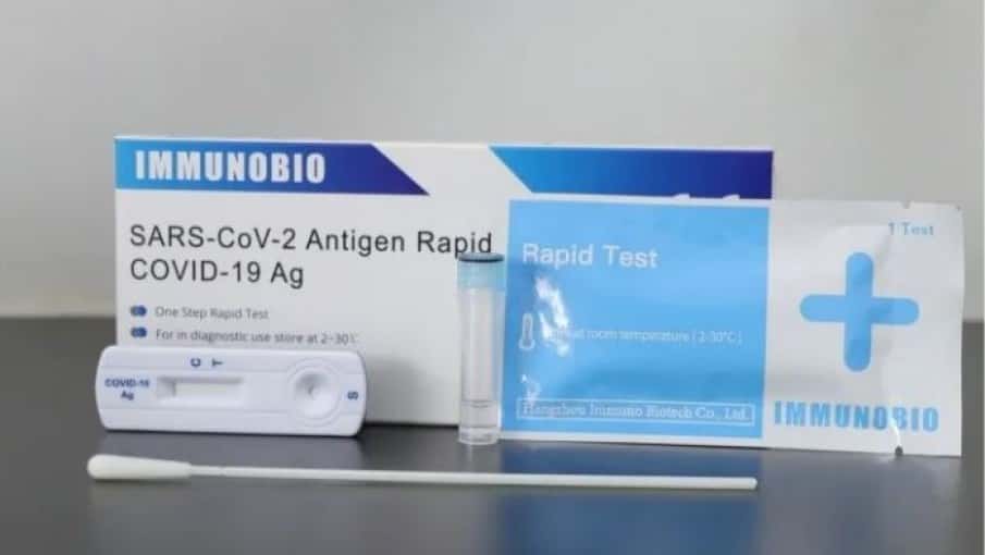 Prohibieron la venta libre en farmacias de test rápidos para detectar coronavirus