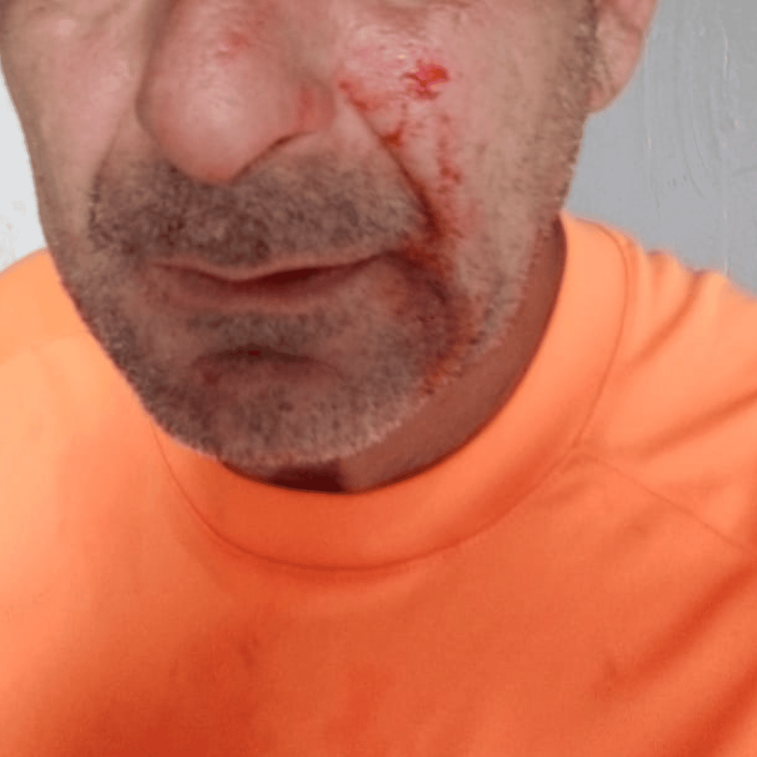 Fútbol violento: citaron al jugador de Las Palmeras que golpeó a un árbitro