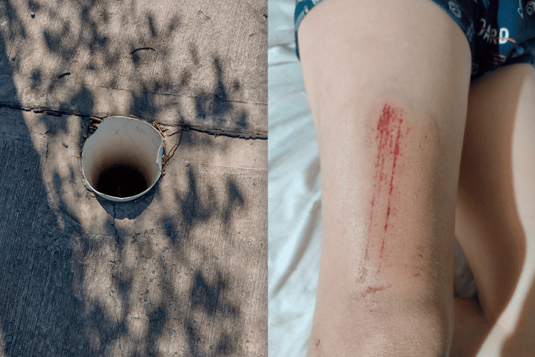 Paseo de los canastos: niño metió la pierna en un caño abierto y se lastimó