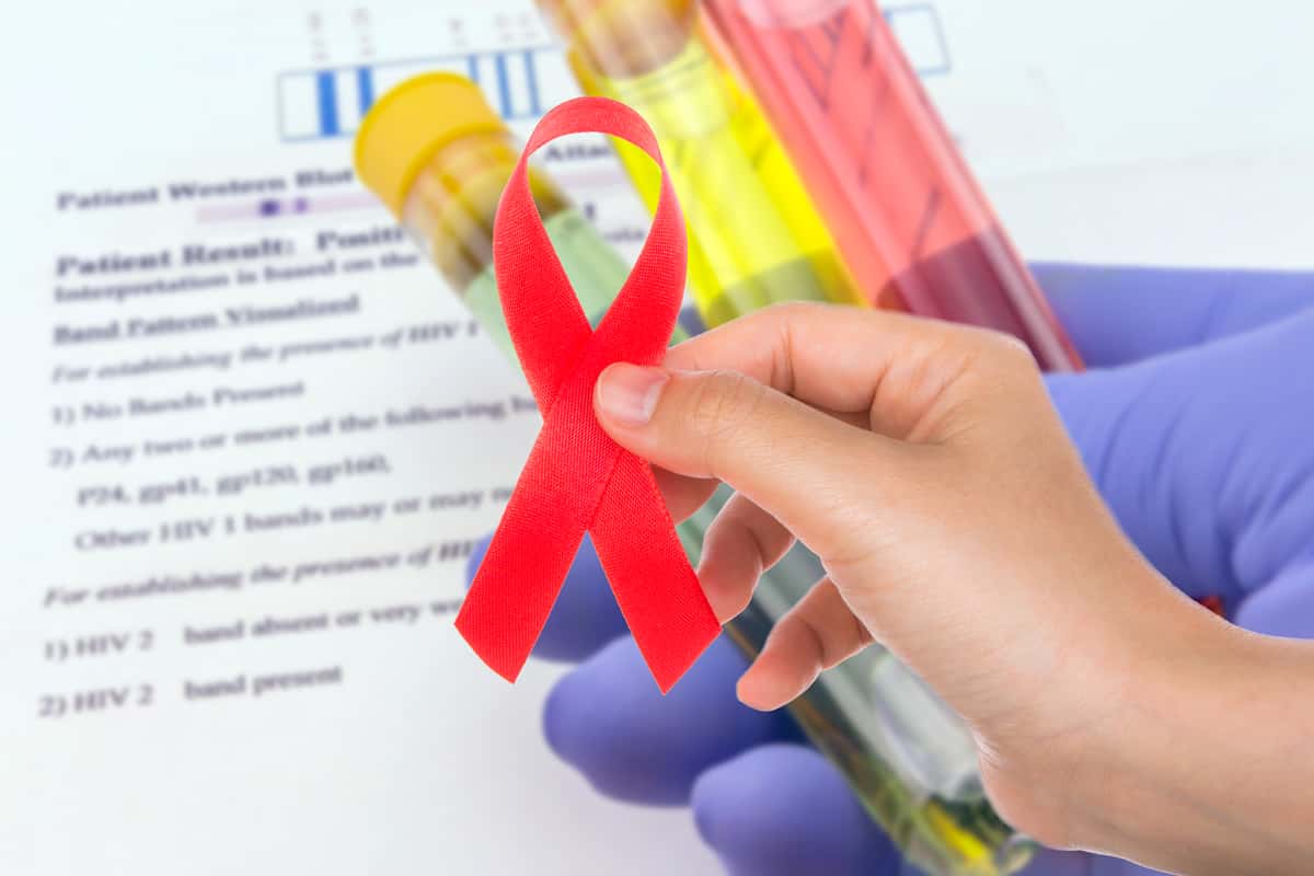 Campaña de VIH: suspendida