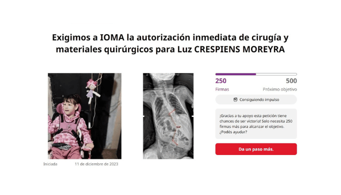 Operación de Luz: firmas para exigir a IOMA que pague la prótesis de la niña