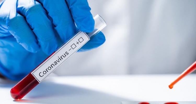 Coronavirus: Nueva muestra arrojó resultados negativos