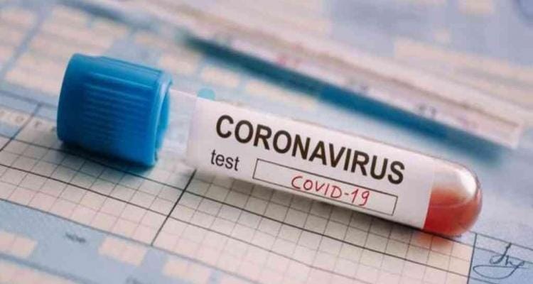 Coronavirus: con 18 nuevos casos positivos, el total de activos volvió a superar los 100