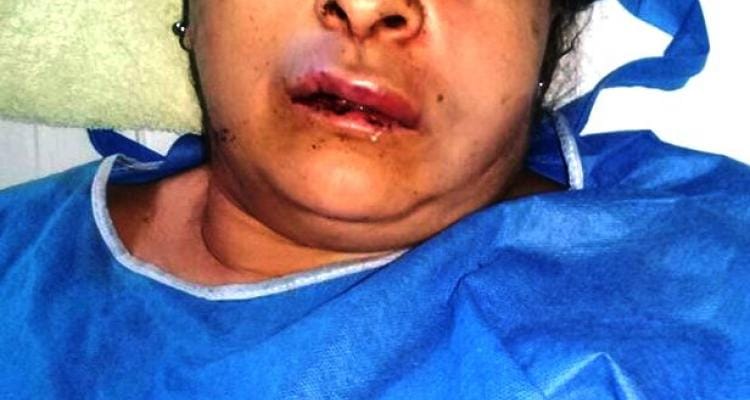 Violencia de género: Tras una brutal paliza, una mujer se recupera en el Hospital