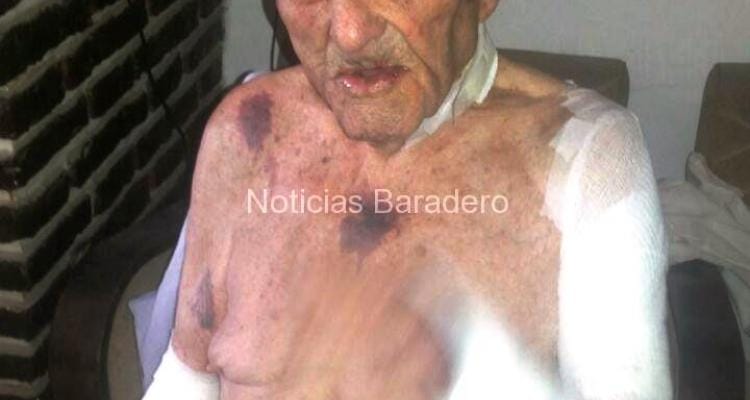 Baradero: Golpearon salvajemente a un hombre de 96 años para robarle dinero
