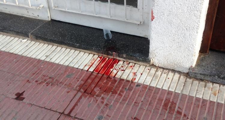 El joven golpeado a la salida de un boliche se negó a permanecer hospitalizado