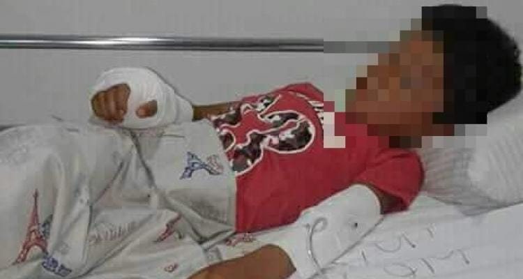 Nene baleado en la calle: “La bala le tocó un hueso y la mano no le va a quedar bien”