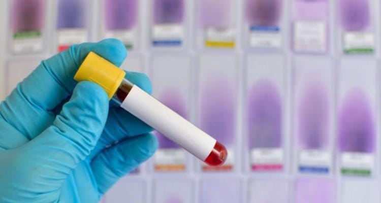 Coronavirus: descartan otro caso en San Pedro y envían una nueva muestra a analizar
