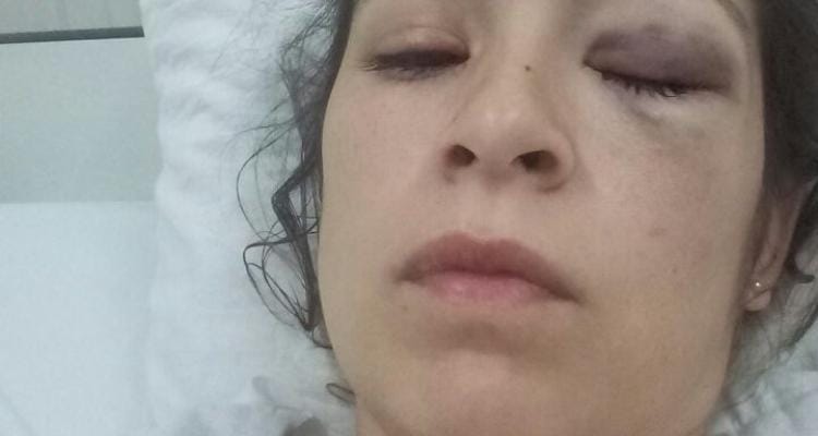 Una joven estuvo internada en el hospital por una golpiza que le propinó su pareja