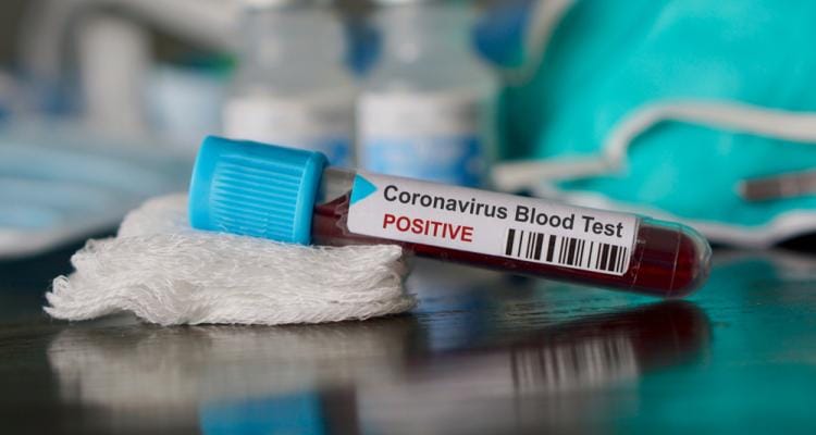 Coronavirus: Hay 39 casos positivos más y casi 100 muestras pendientes