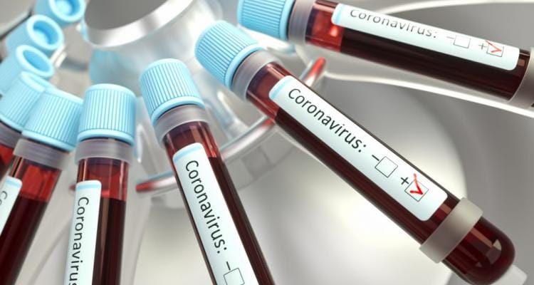Coronavirus: San Pedro empezó septiembre con 17 nuevos casos positivos