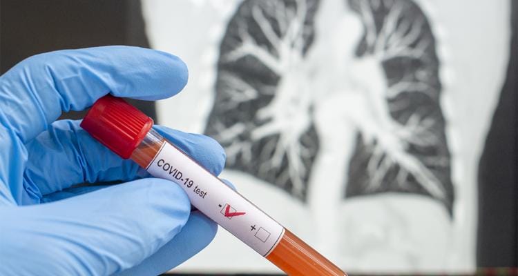Coronavirus: sin resultados del Malbrán, ocho nuevos casos positivos y 178 muestras pendientes