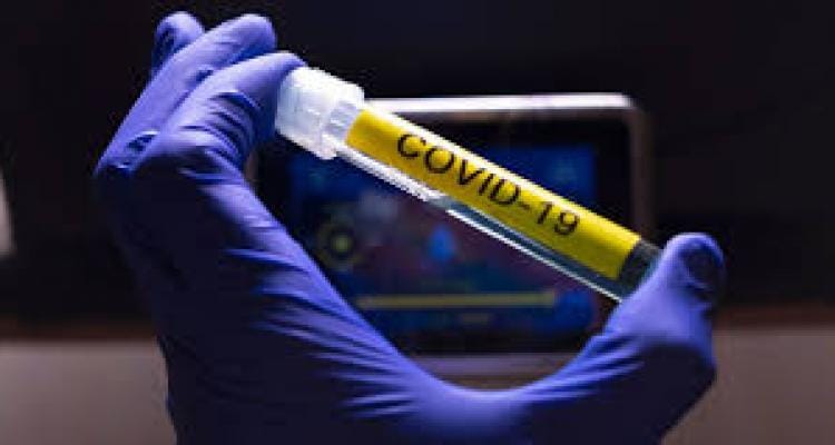 Coronavirus: llegaron 33 nuevos casos positivos y quedan 90 muestras pendientes