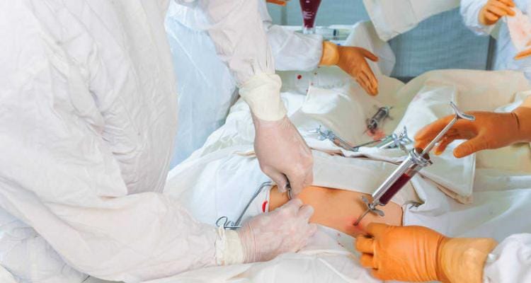 Una sampedrina donará médula ósea a un paciente alemán
