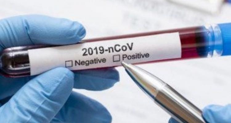 Coronavirus: Sin resultados del Instituto Malbrán, confirmaron nueve casos positivos por hisopado