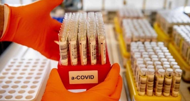Coronavirus: Con 54 nuevos positivos, San Pedro se acerca al millar de contagiados