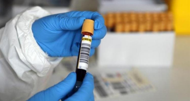 Coronavirus: Hay catorce nuevos casos positivos, la mitad de ellos procesados en laboratorios privados