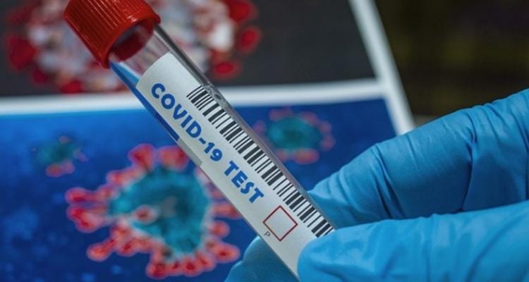 Coronavirus: expectativa por los resultados que llegarán este lunes desde el Instituto Maiztegui
