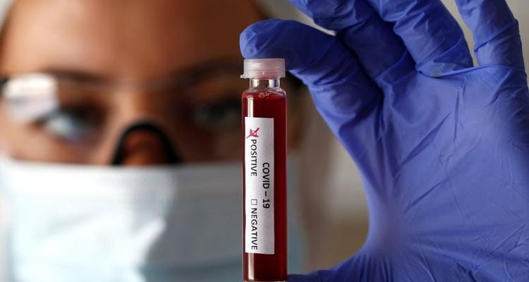 Coronavirus: murieron dos pacientes que estaban internados y se esperan sus resultados