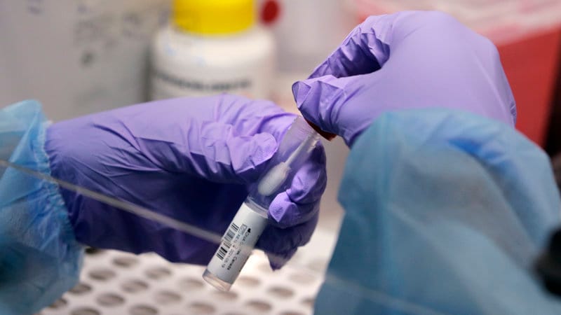 Coronavirus: 36 nuevos casos positivos y 76 resultados negativos para San Pedro