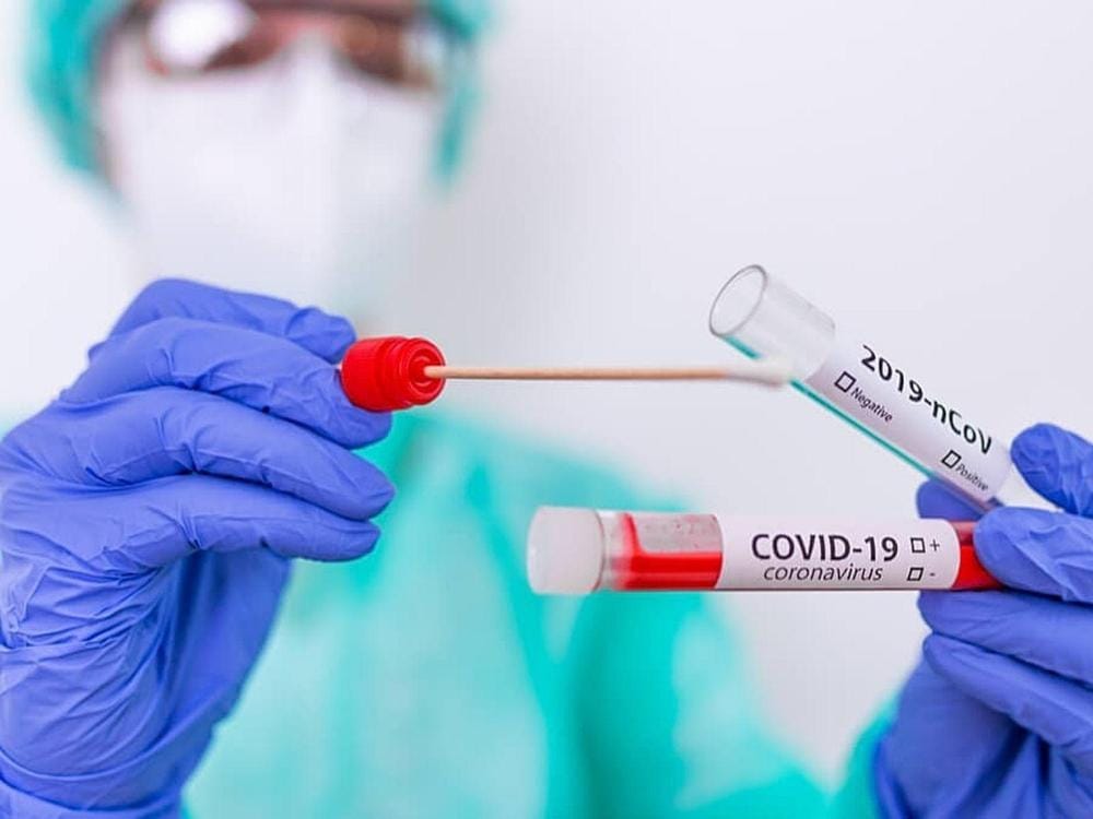Segunda ola de coronavirus: con 39 nuevos contagios, hay 216 casos activos