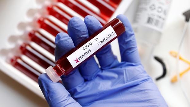 Segunda ola de coronavirus: 28 nuevos casos positivos