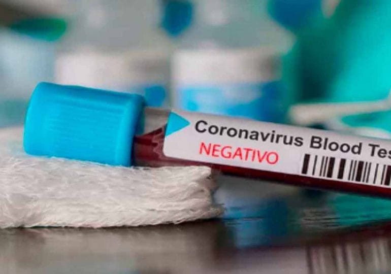 Segunda ola de coronavirus: sin resultados, este lunes los activos bajaron a 76