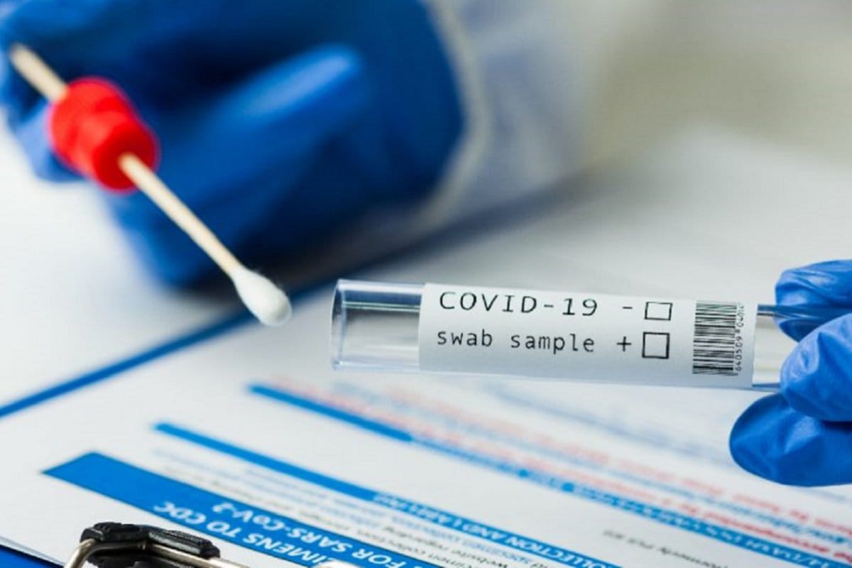 Coronavirus: 80 nuevos casos positivos detectados en los testeos del viernes