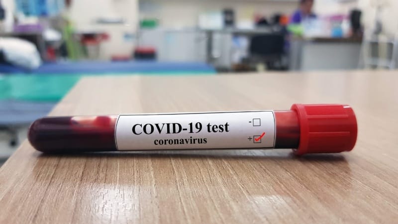 Segunda ola de coronavirus: 34 nuevos casos positivos
