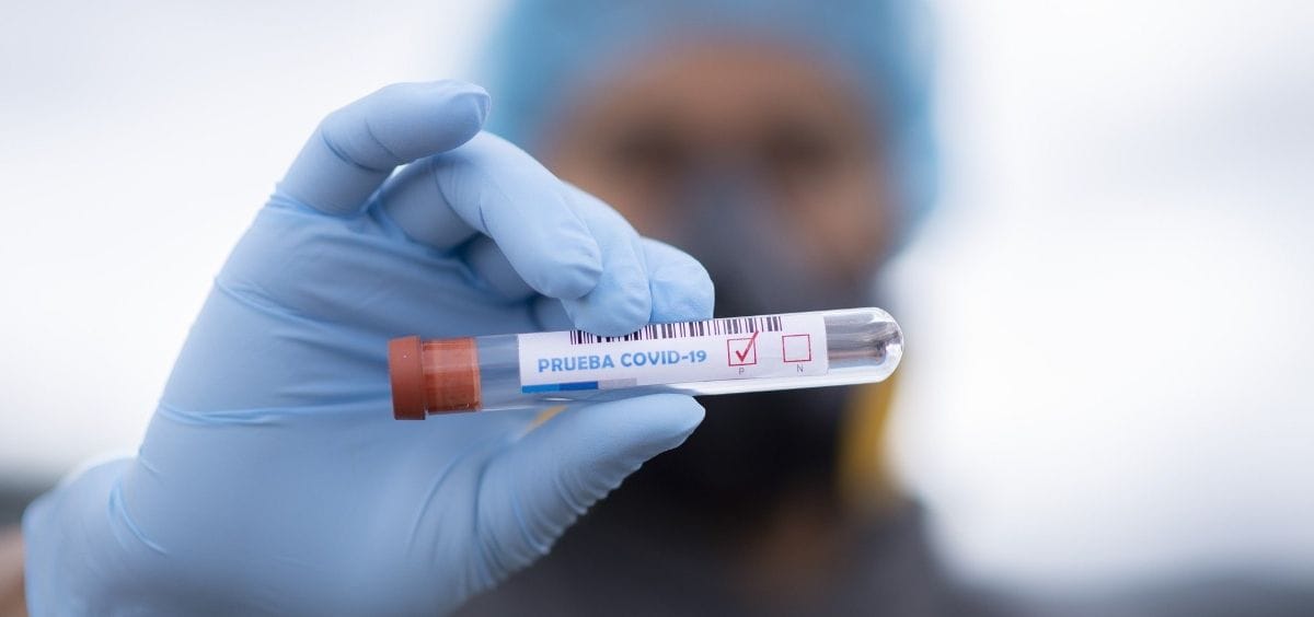 Segunda ola de coronavirus: 31 nuevos casos positivos, todos a través de testeos rápidos