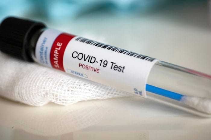 Coronavirus: 35 nuevos positivos y más de 80 PCR en espera